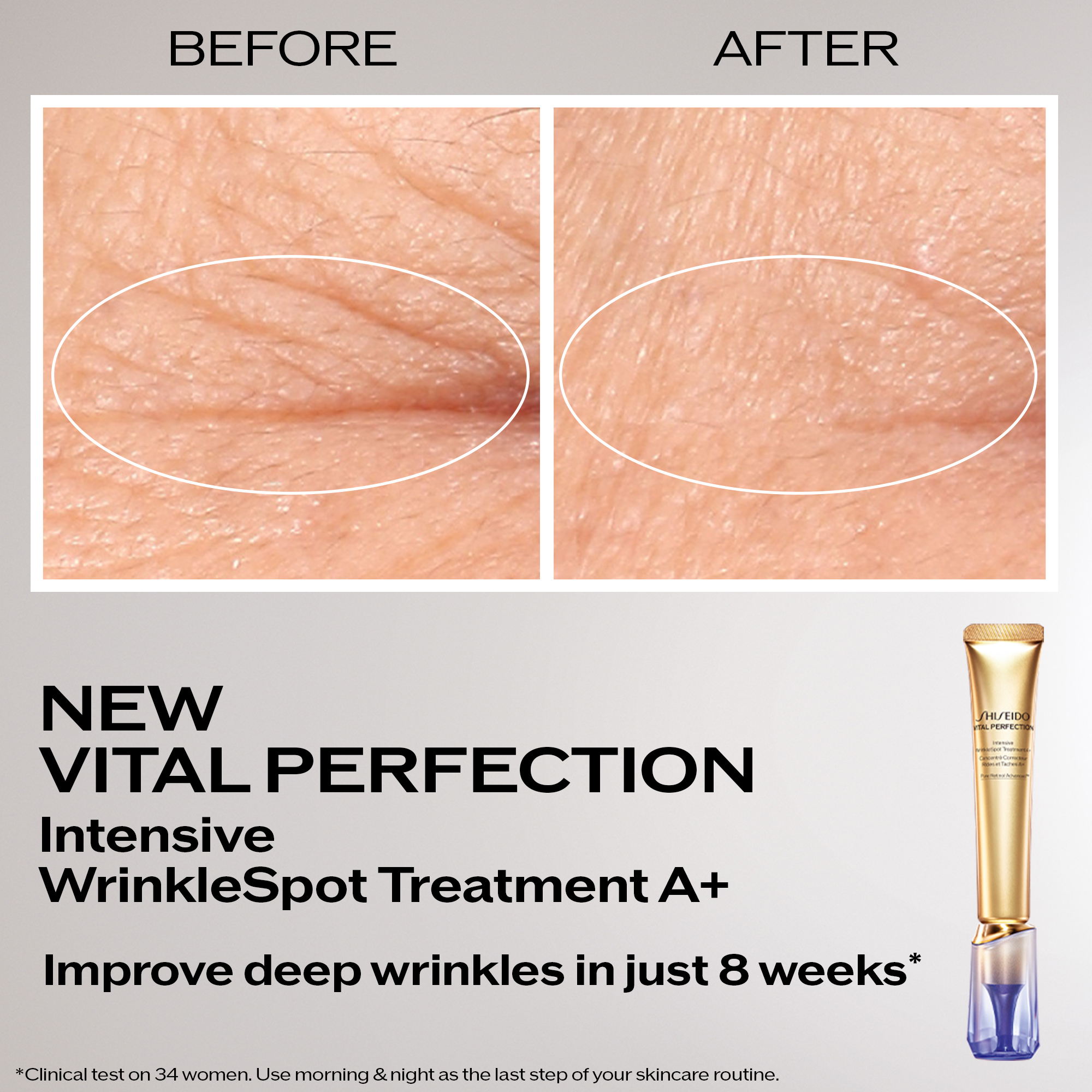 Intensive Wrinklespot Treatment A+, 